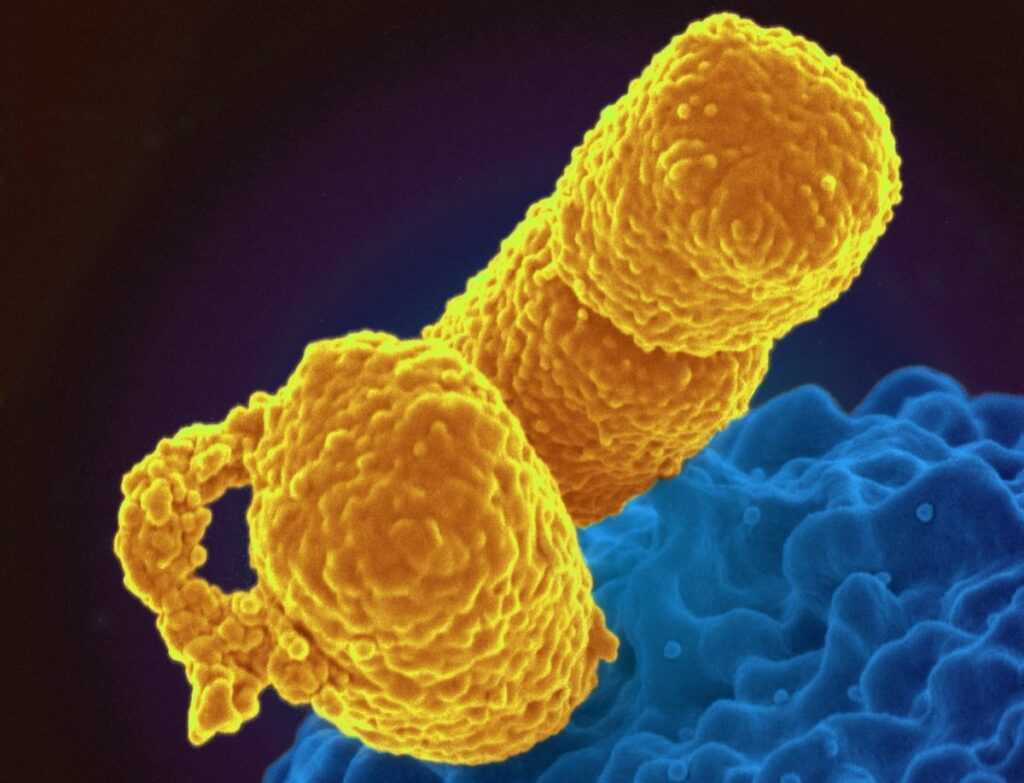 klebsiella-resistant-1200x917